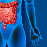 Intestino Permeable. El origen del Origen